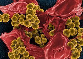 Why your body armor odor smells so bad, how it can kill you and a solution to get rid of it!